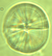 Gehörsteinchen (Otolith) einer Heringslarve mit sichtbarer Tagesringstruktur.